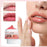 Lips Bleaching Cream Balm l Lip Cream l Vitamin E Cream l Lip Lightening Cream