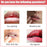 Lips Bleaching Cream Balm l Lip Cream l Vitamin E Cream l Lip Lightening Cream