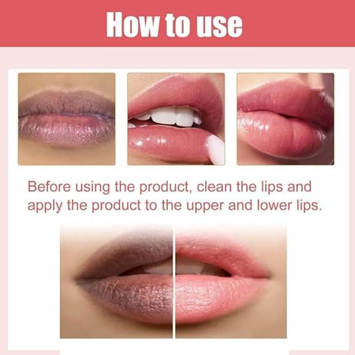 Lips Bleaching Cream Balm l Lip Cream l Vitamin E Cream l Lip Lightening Cream