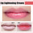 Lips Bleaching Cream Balm l Lip Cream l Vitamin E Cream l Lip Lightening Cream